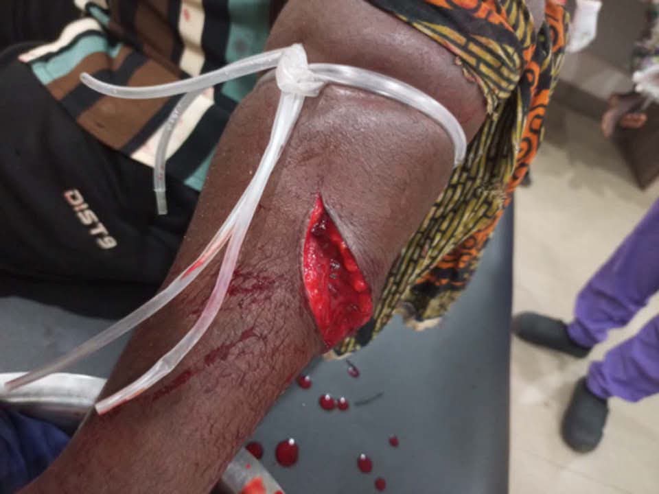 Bandits take over Taraba communities, kidnapped monarch, killed 5, displaced hundreds of villagers